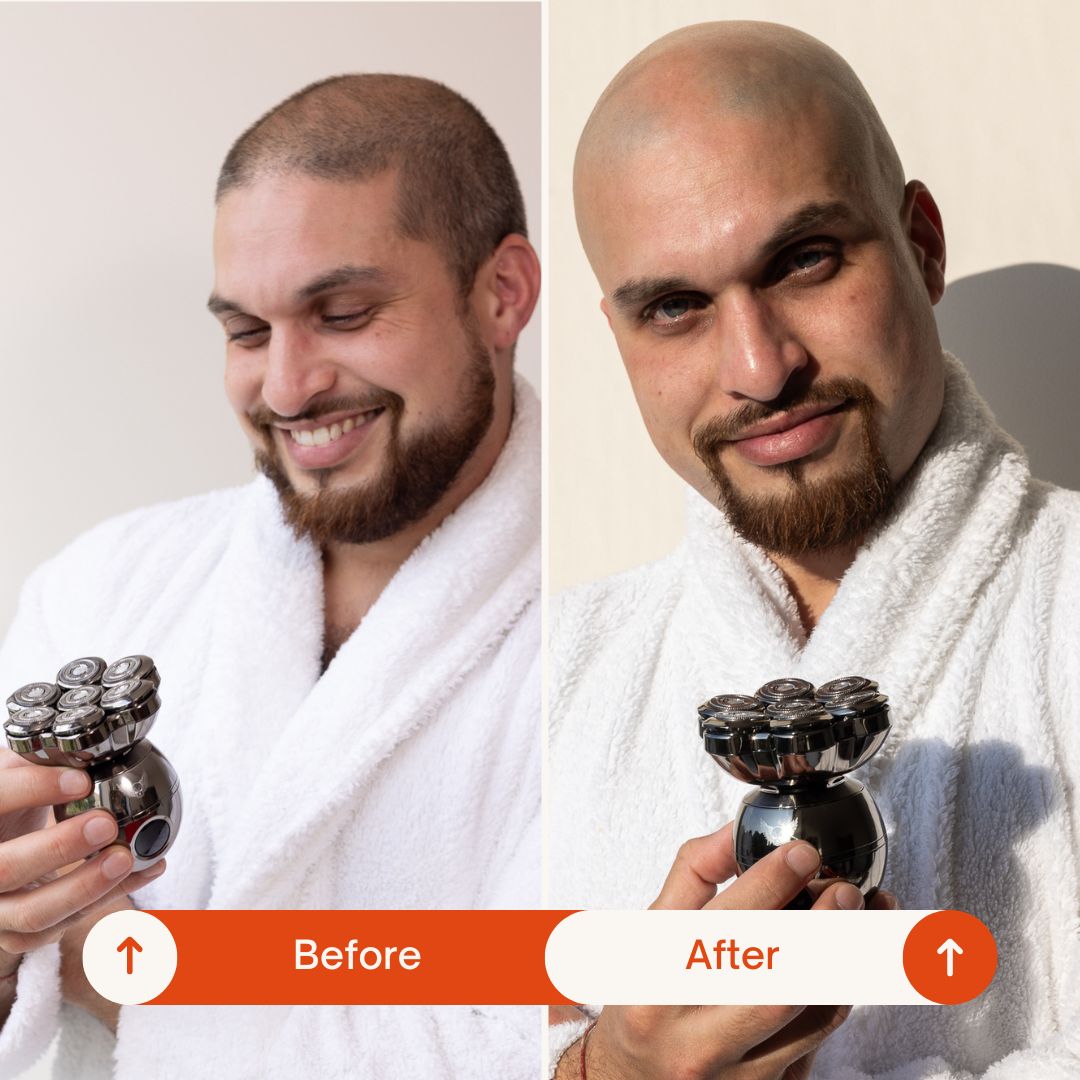 TrimPod 3.0: The Ultimate Shaver For Men