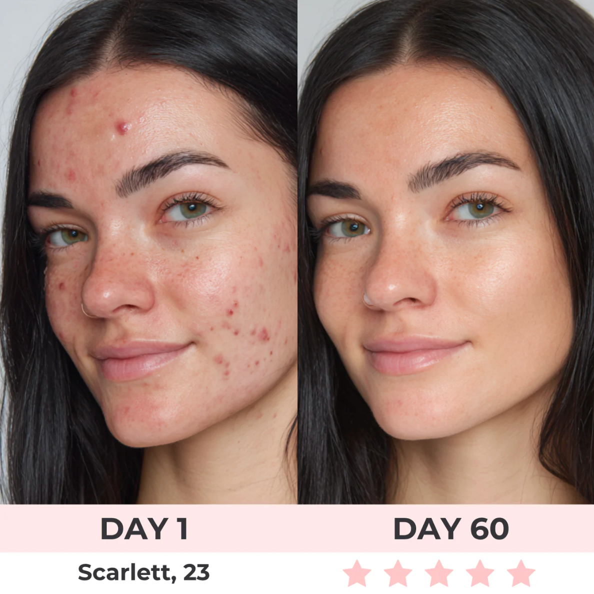 Contour Face LED Therapy Mask